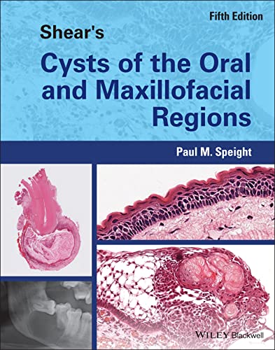 Shear's Cysts of the Oral and Maxillofacial Regions von Wiley-Blackwell